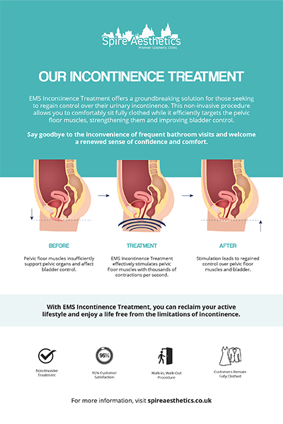 image to show how EMS treatment works for female urinary incontinence South Side